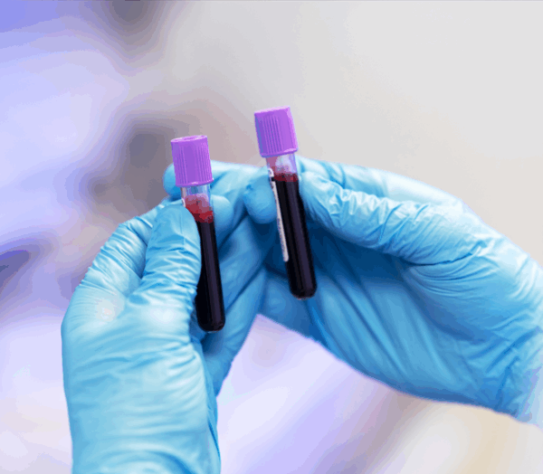 Tratamiento de plasma rico en plaquetas